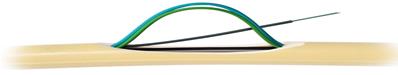 CABLE DISTRI A MICRO MODULES FTTH 72 FO - MODULO 6